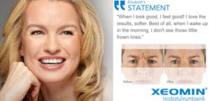 xeomin 4